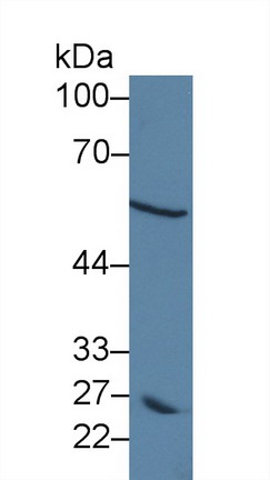 Polyclonal Antibody to Dopachrome Tautomerase (DCT)