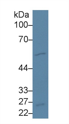 Polyclonal Antibody to Dopachrome Tautomerase (DCT)