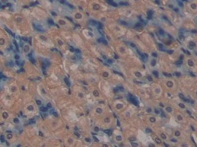 Polyclonal Antibody to Multidrug Resistance Associated Protein 1 (MRP1)