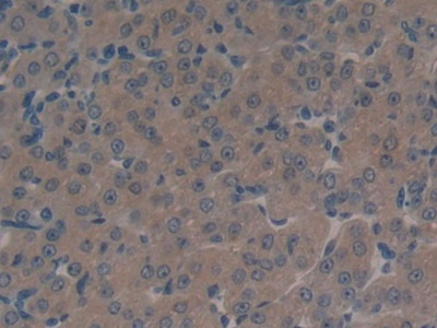 Polyclonal Antibody to Multidrug Resistance Associated Protein 1 (MRP1)