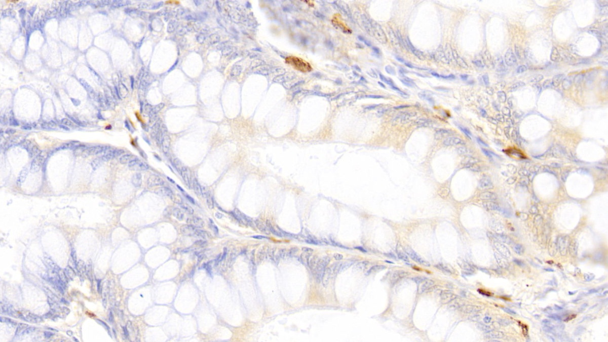 Polyclonal Antibody to Tryptase (TPS)