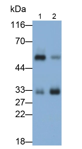 Polyclonal Antibody to Tryptase (TPS)