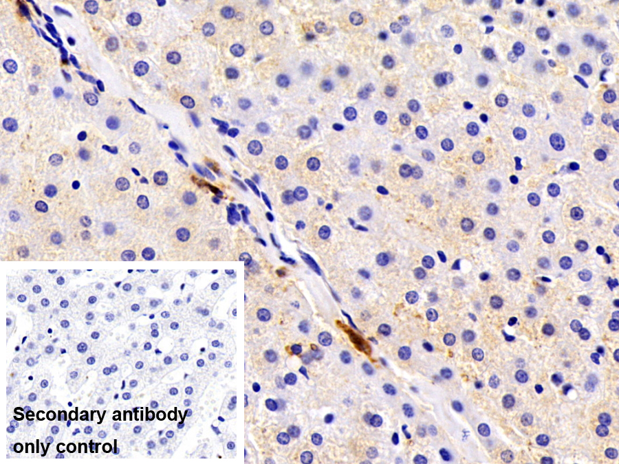 Polyclonal Antibody to Tryptase (TPS)