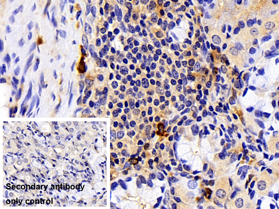 Polyclonal Antibody to Tryptase (TPS)