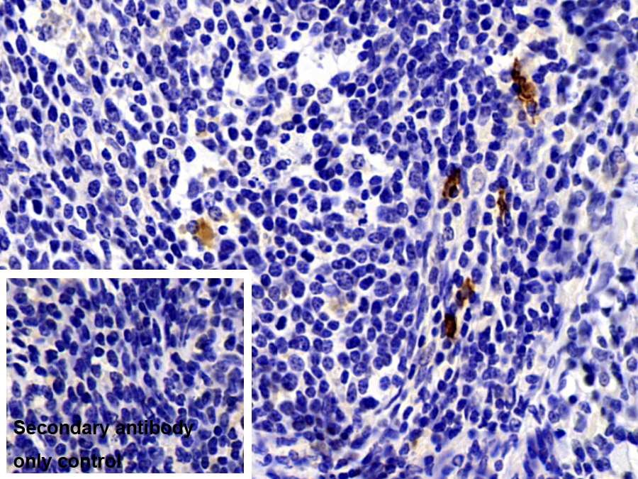 Polyclonal Antibody to Tryptase (TPS)