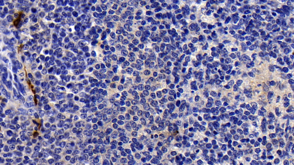 Polyclonal Antibody to Tryptase (TPS)