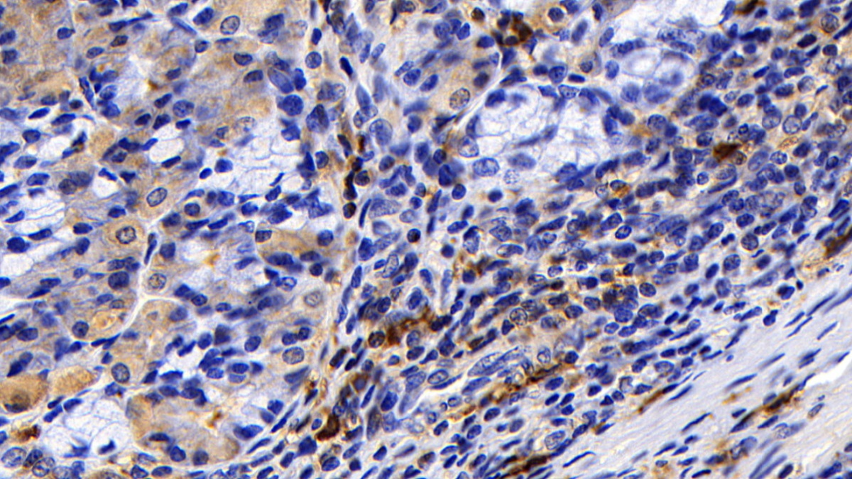 Polyclonal Antibody to Tryptase (TPS)