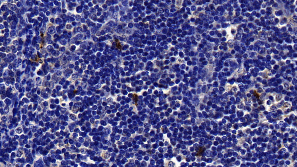 Polyclonal Antibody to Tryptase (TPS)