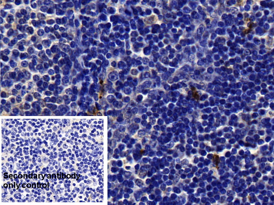 Polyclonal Antibody to Tryptase (TPS)