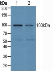 Polyclonal Antibody to Ubiquitin Protein Ligase E3A (UBE3A)