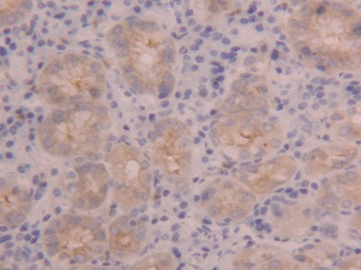 Polyclonal Antibody to Polymeric Immunoglobulin Receptor (PIGR)