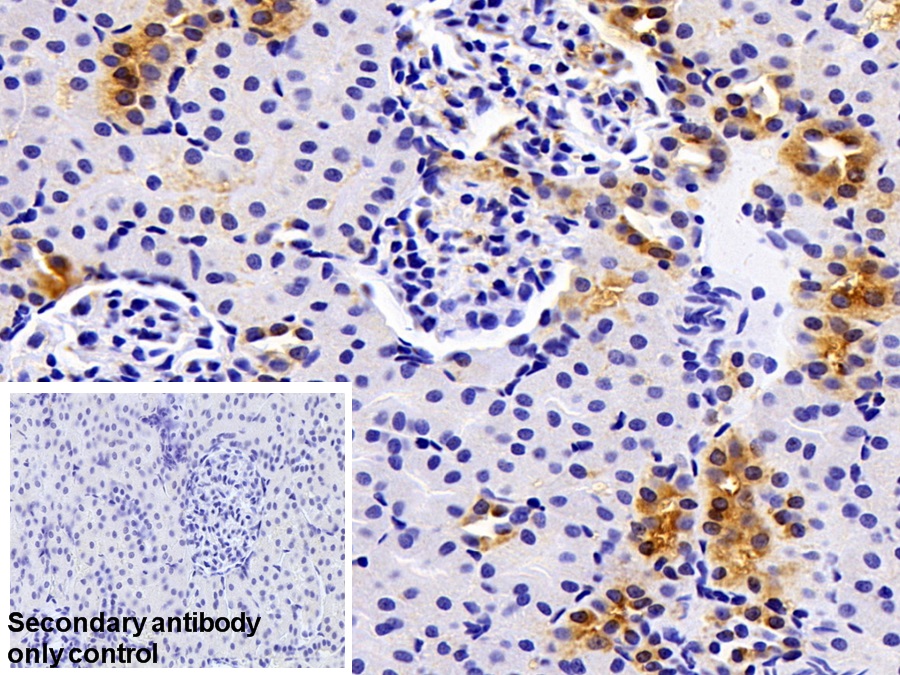 Polyclonal Antibody to Polymeric Immunoglobulin Receptor (PIGR)