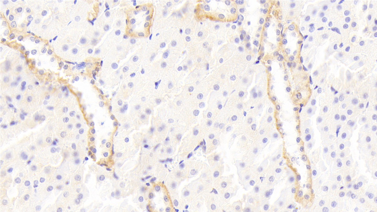 Polyclonal Antibody to Polymeric Immunoglobulin Receptor (PIGR)