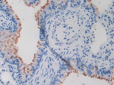 Polyclonal Antibody to Secretin (SCT)