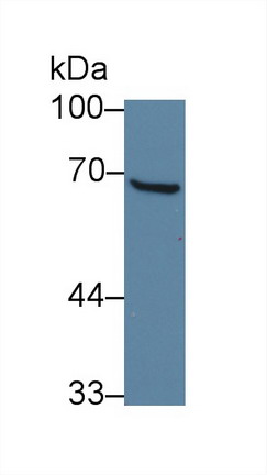 Polyclonal Antibody to General Transcription Factor IIH Subunit 1 (GTF2H1)