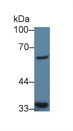 Polyclonal Antibody to General Transcription Factor IIH Subunit 1 (GTF2H1)