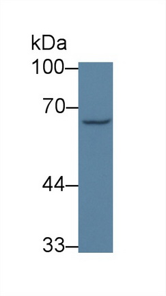 Polyclonal Antibody to General Transcription Factor IIH Subunit 1 (GTF2H1)