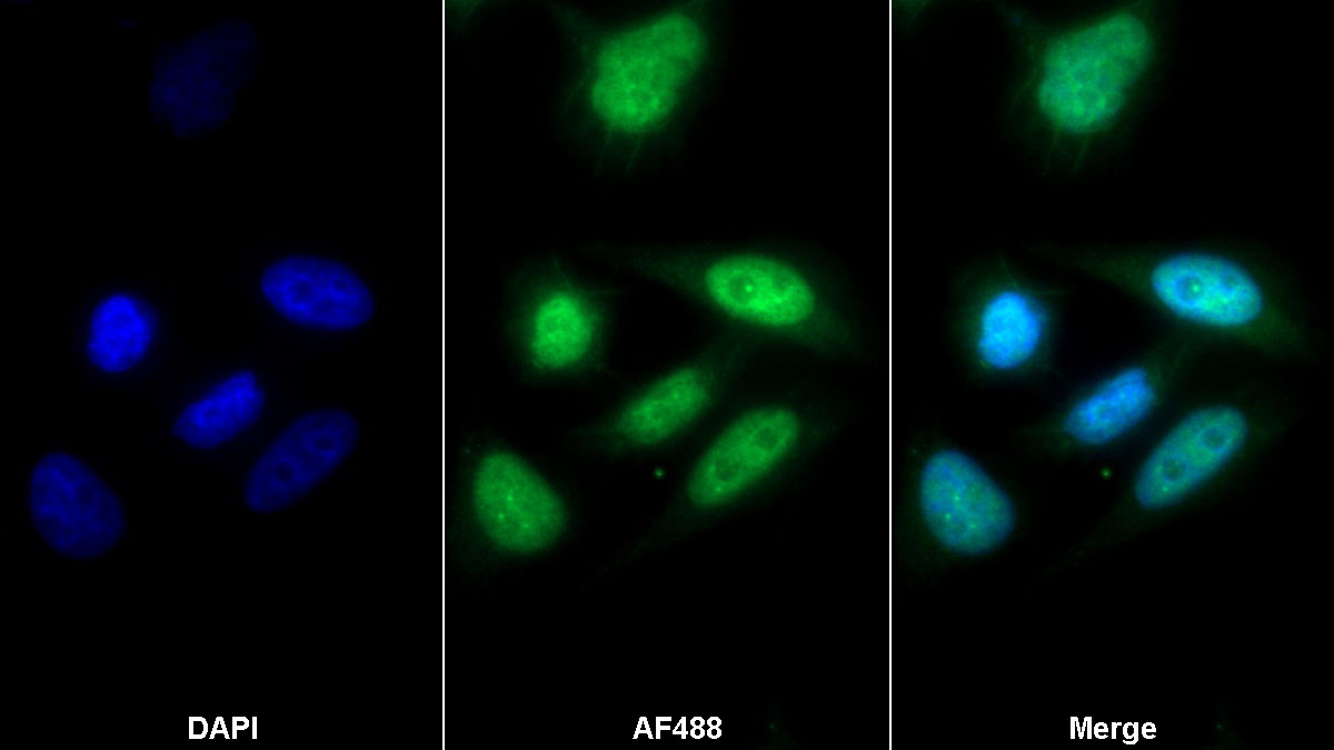 Polyclonal Antibody to General Transcription Factor IIH Subunit 1 (GTF2H1)