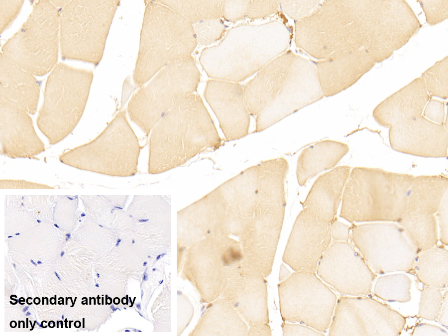 Polyclonal Antibody to General Transcription Factor IIH Subunit 1 (GTF2H1)