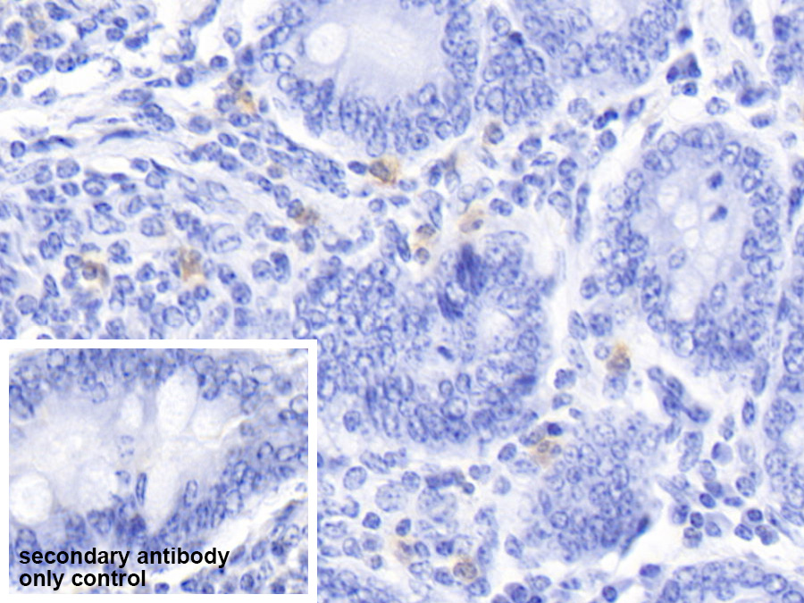 Polyclonal Antibody to S100 Calcium Binding Protein A12 (S100A12)