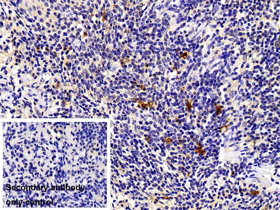 Polyclonal Antibody to S100 Calcium Binding Protein A12 (S100A12)