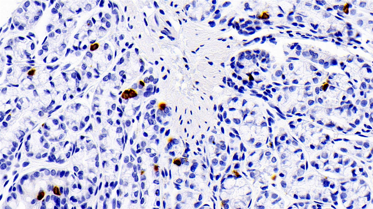 Polyclonal Antibody to S100 Calcium Binding Protein A12 (S100A12)