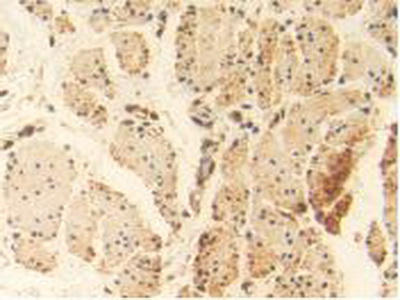 Polyclonal Antibody to Heat Shock 70kDa Protein 1A (HSPA1A)