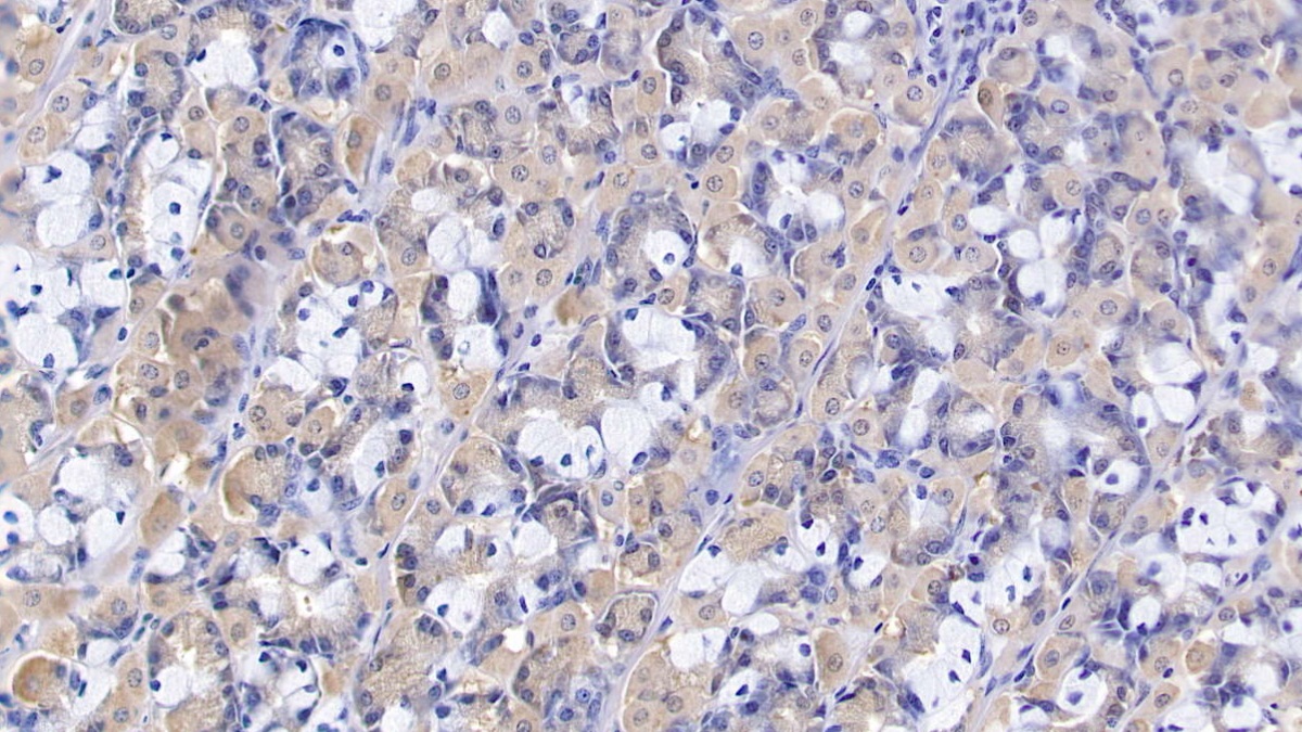 Polyclonal Antibody to Heat Shock 70kDa Protein 9 (HSPA9)