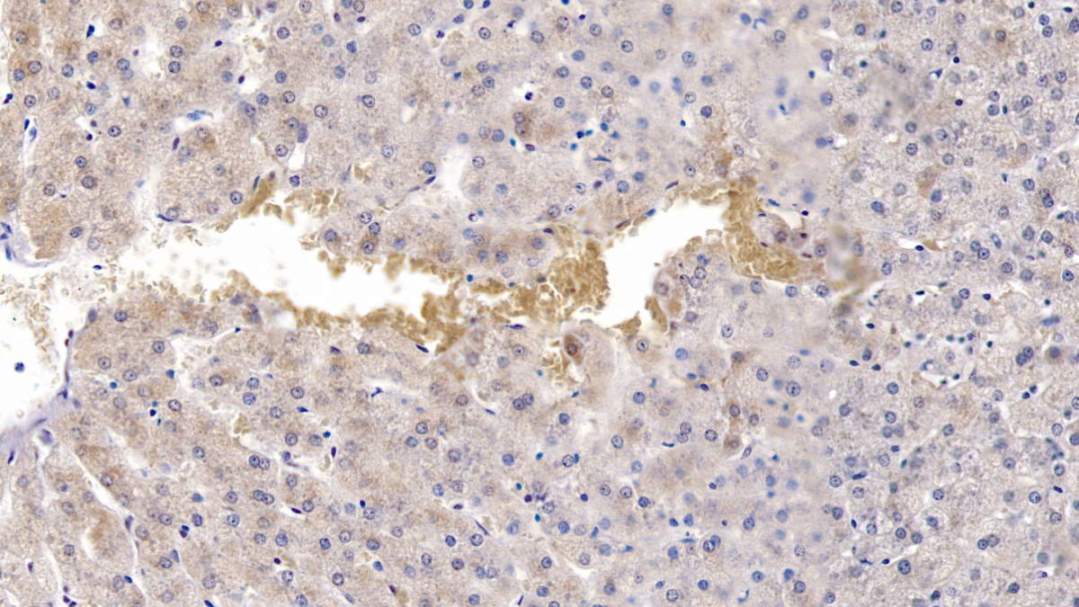 Polyclonal Antibody to Heat Shock 70kDa Protein 9 (HSPA9)