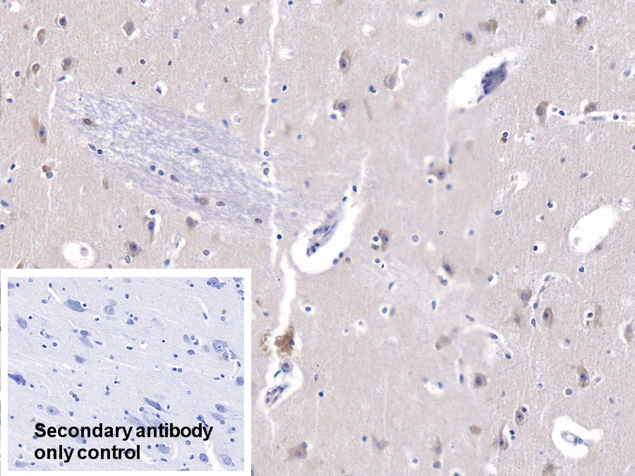 Polyclonal Antibody to Heat Shock 70kDa Protein 9 (HSPA9)