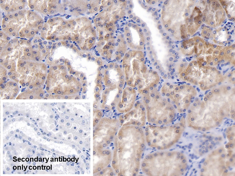 Polyclonal Antibody to Heat Shock 70kDa Protein 9 (HSPA9)