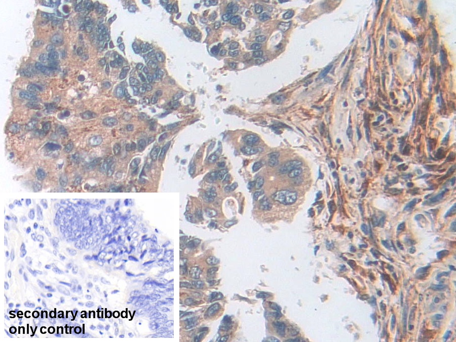 Polyclonal Antibody to Superoxide Dismutase 2, Mitochondrial (SOD2)