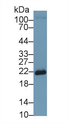 Polyclonal Antibody to Superoxide Dismutase 2, Mitochondrial (SOD2)