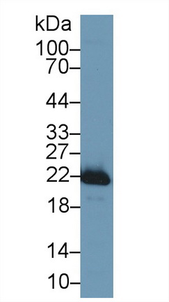 Polyclonal Antibody to Superoxide Dismutase 2, Mitochondrial (SOD2)