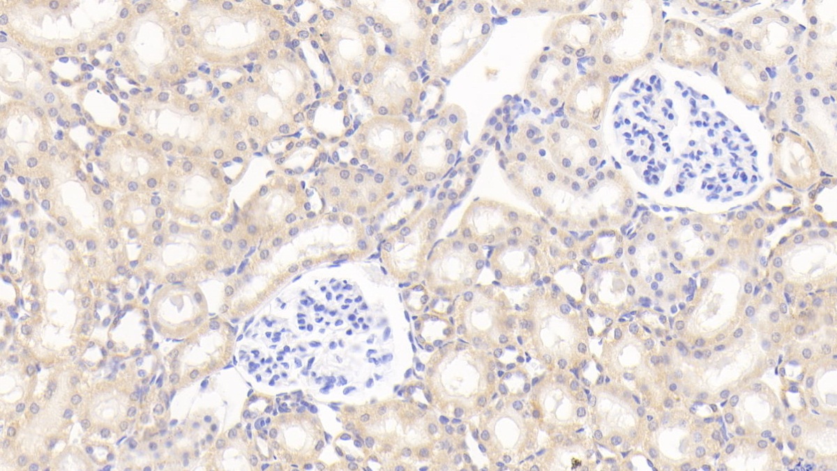 Polyclonal Antibody to Superoxide Dismutase 2, Mitochondrial (SOD2)