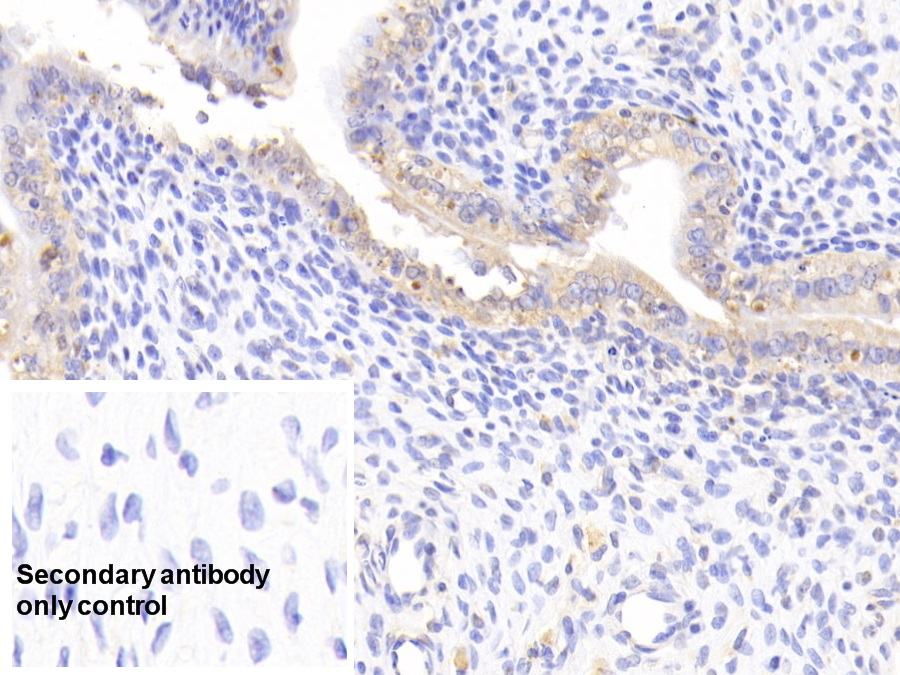 Polyclonal Antibody to Superoxide Dismutase 2, Mitochondrial (SOD2)