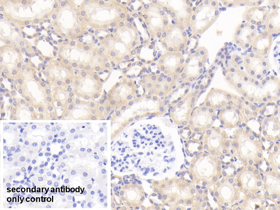 Polyclonal Antibody to Superoxide Dismutase 2, Mitochondrial (SOD2)