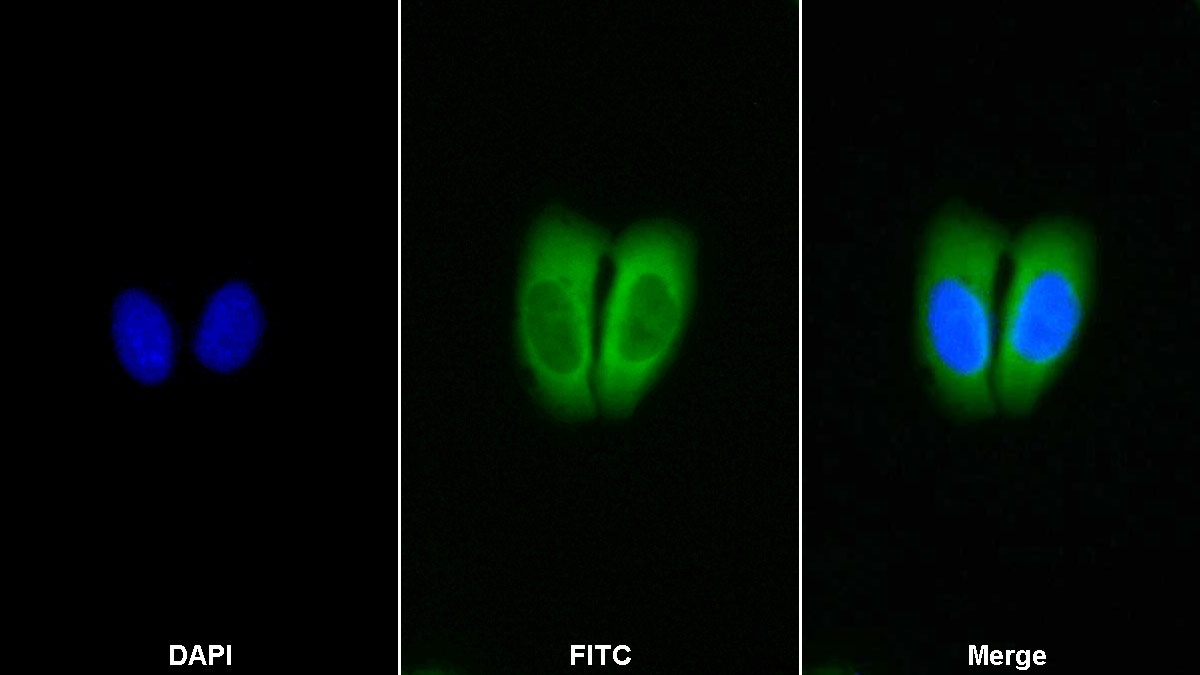 Polyclonal Antibody to Superoxide Dismutase 2, Mitochondrial (SOD2)