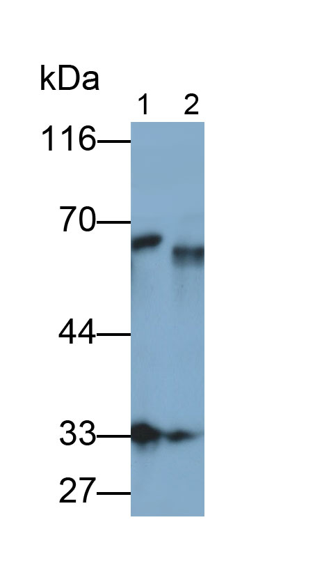 Polyclonal Antibody to Alkaline Phosphatase, Intestinal (ALPI)