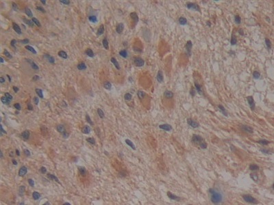 Polyclonal Antibody to Nucleoporin 37 (NUP37)