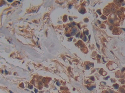 Polyclonal Antibody to Nucleoporin 37 (NUP37)