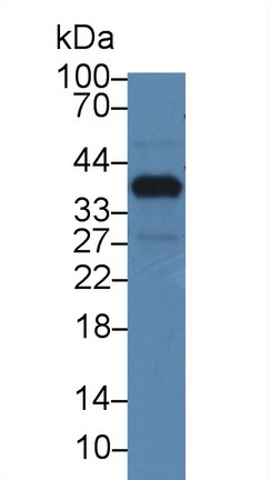 Polyclonal Antibody to Nucleoporin 37 (NUP37)