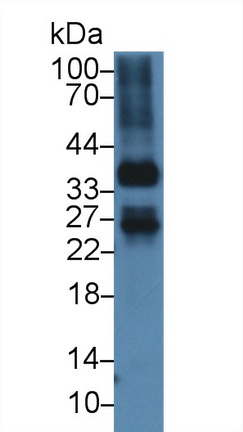 Polyclonal Antibody to Nucleoporin 37 (NUP37)