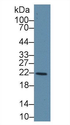 Polyclonal Antibody to Glutathione S Transferase Kappa 1 (GSTk1)