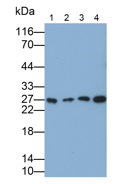 Polyclonal Antibody to Glutathione S Transferase Kappa 1 (GSTk1)