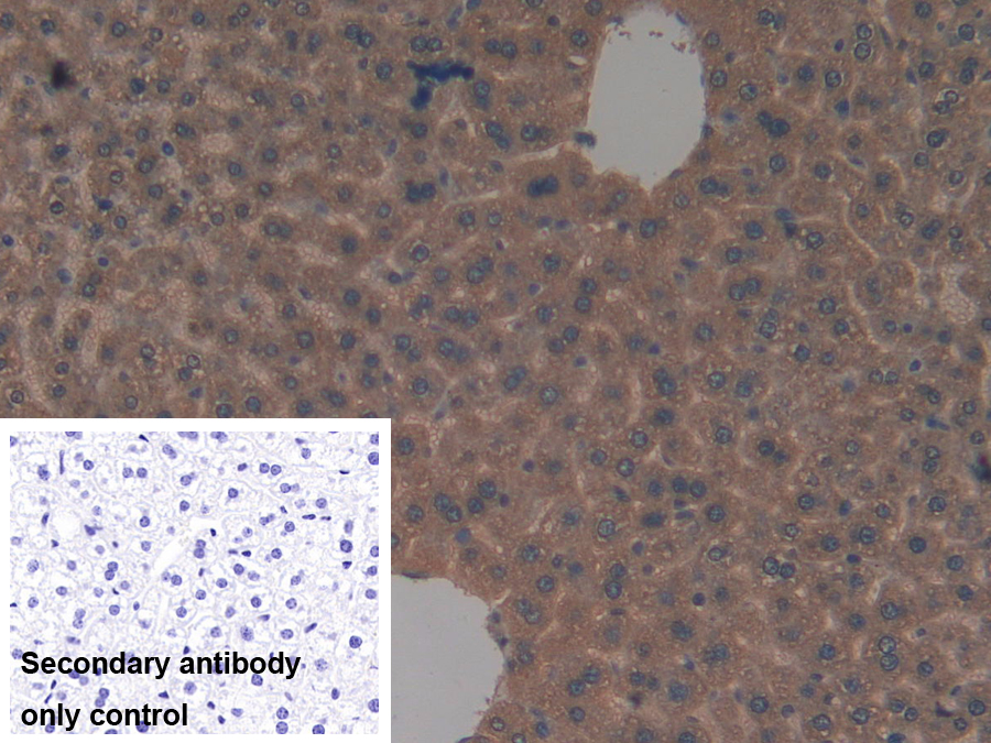 Polyclonal Antibody to Glutathione S Transferase Kappa 1 (GSTk1)