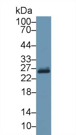 Polyclonal Antibody to Glutathione S Transferase Pi (GSTp)