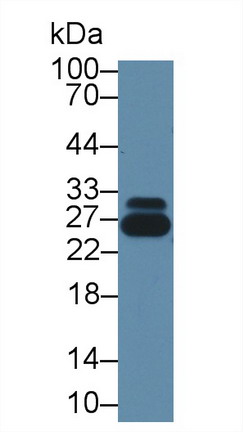 Polyclonal Antibody to Glutathione S Transferase Pi (GSTp)