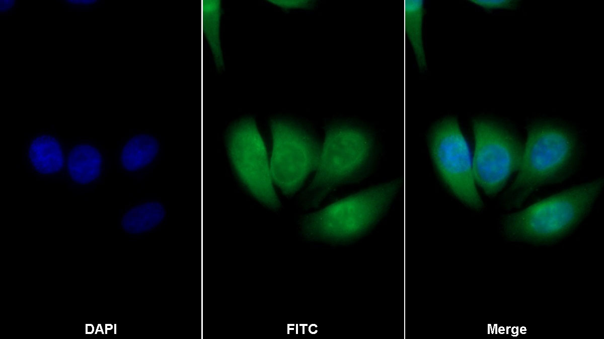 Polyclonal Antibody to Glutathione S Transferase Pi (GSTp)