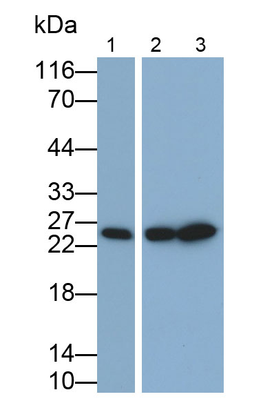 Polyclonal Antibody to Glutathione S Transferase Pi (GSTp)